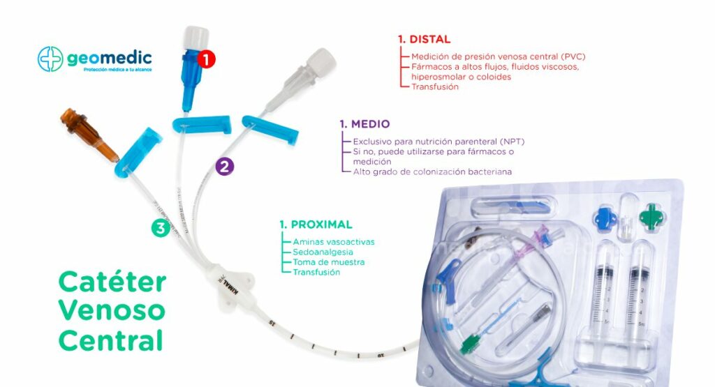 Catéter Venoso Central: Importancia de su Colocación Correcta - GeoMedic
